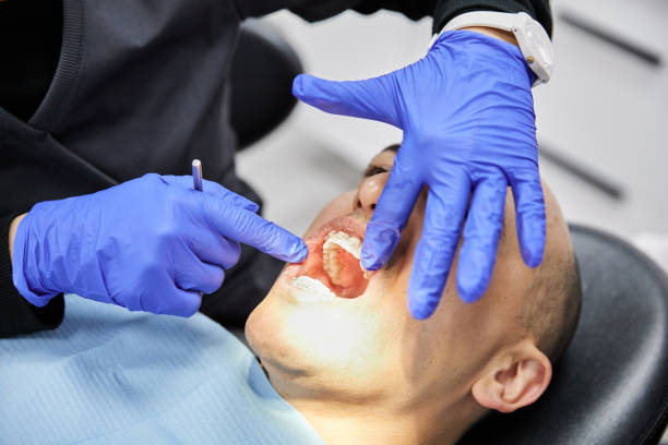 Best Emergency Dentist for Knocked-Out Tooth in Miller Place, NY